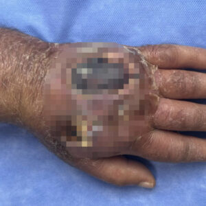 hirsizin isirigi kolundan ediyordu vaka literature girmeye aday dAV1s2CX