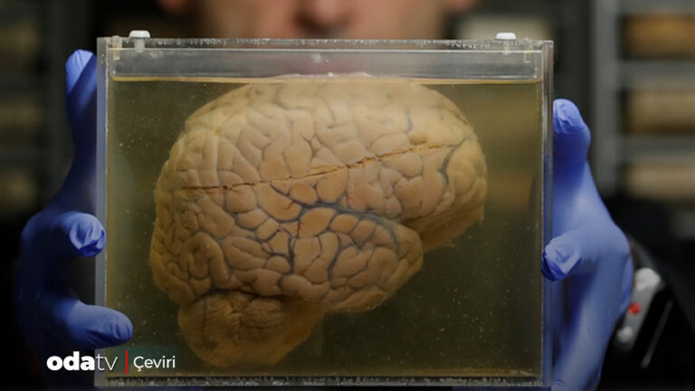 hepsi-bir-binada-binlerce-beyni-depoladilar-bakin-sebebi-ne-FhYSr7HM.jpg
